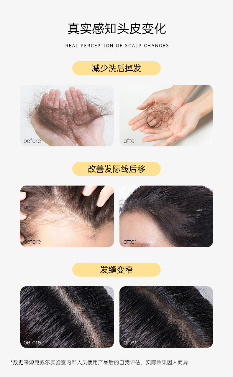 男士生姜洗發(fā)水